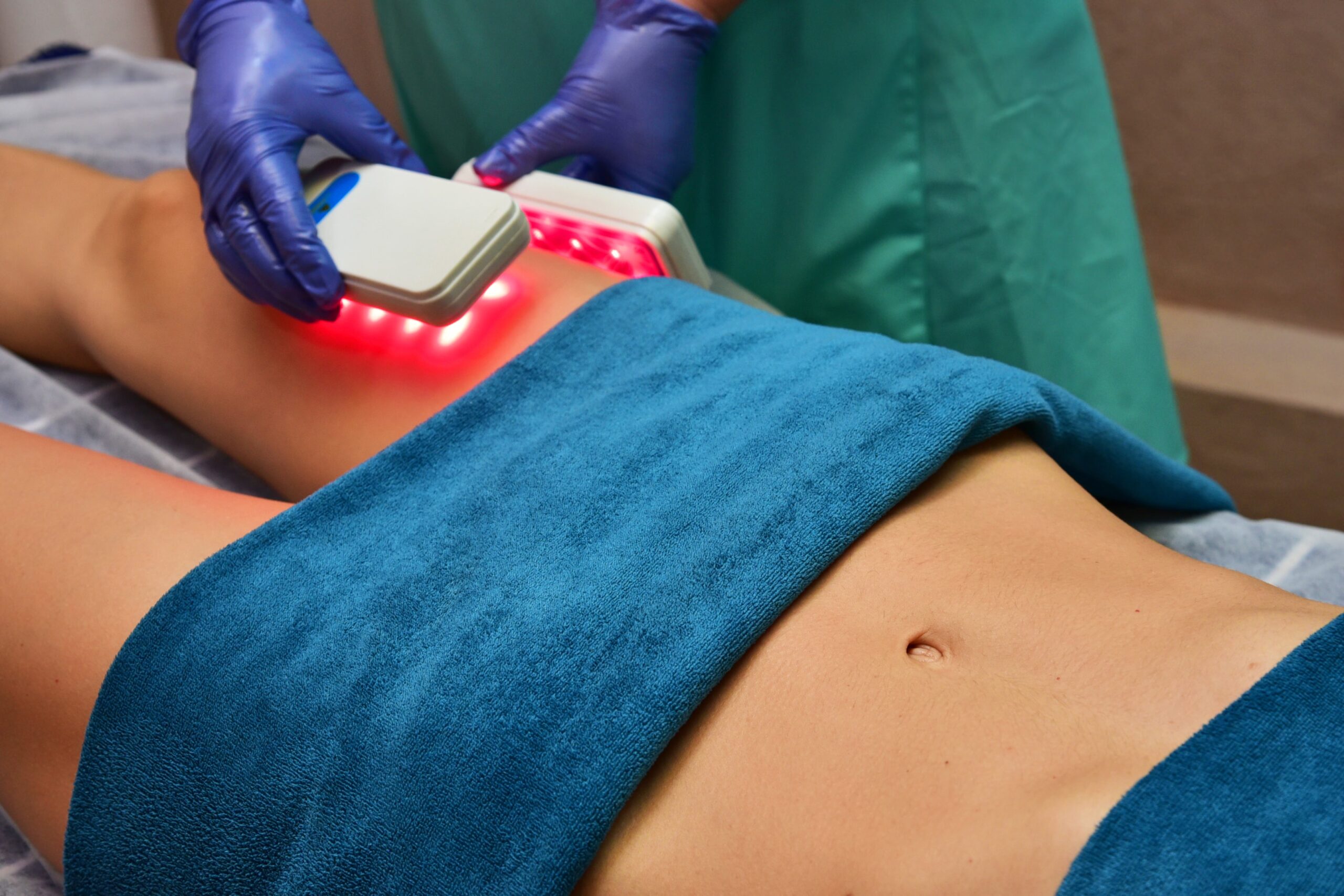 Immagine che rappresenta la liposuzione con laser, mostrando un dispositivo laser in uso.