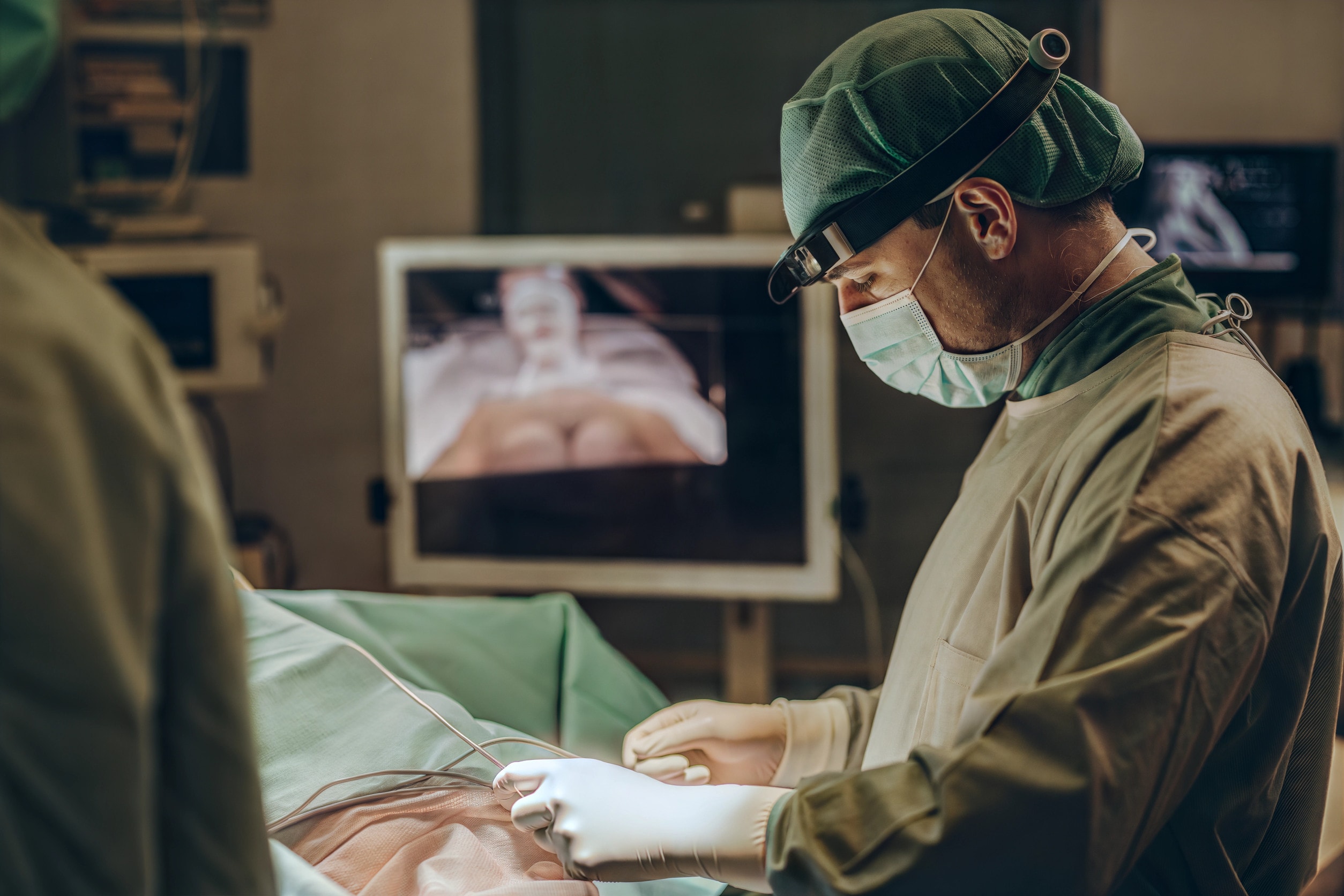 Un'immagine che mostra il processo di liposuzione addominale in corso, con un focus sulla tecnica utilizzata.