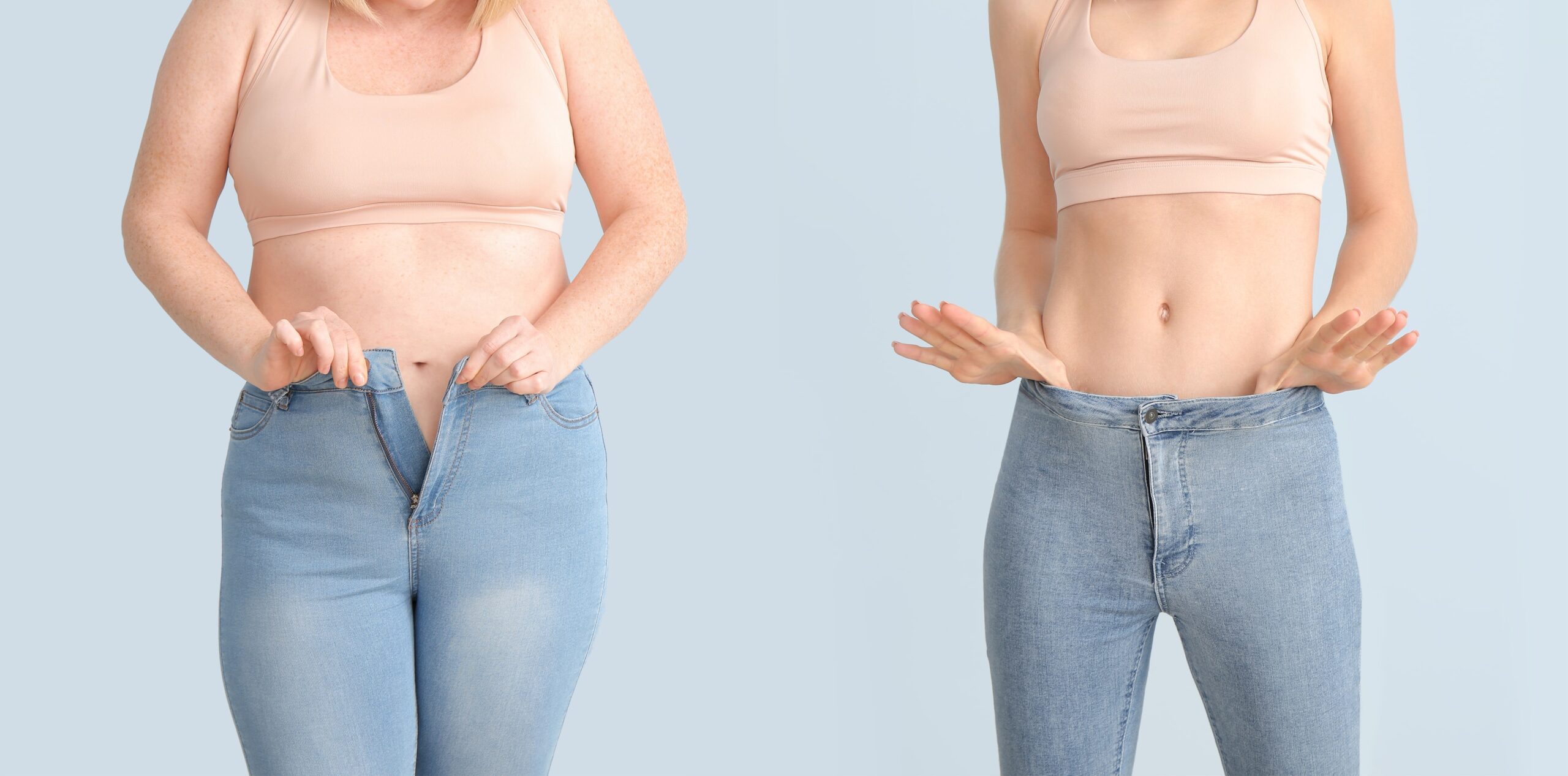 Foto dei risultati della liposuzione della pancia prima e dopo l'intervento