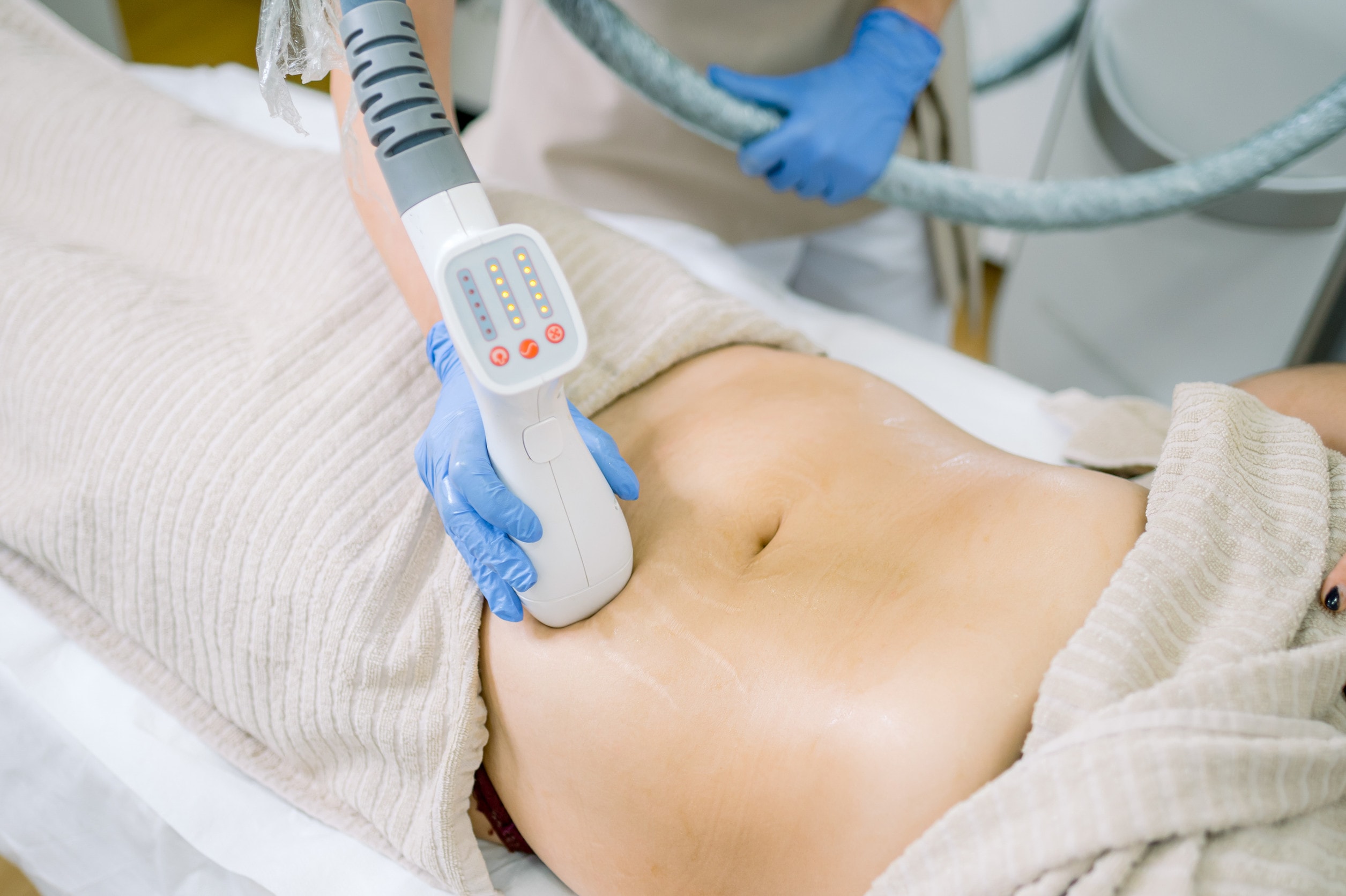 Una donna che esplora alternative alla liposuzione ai fianchi.