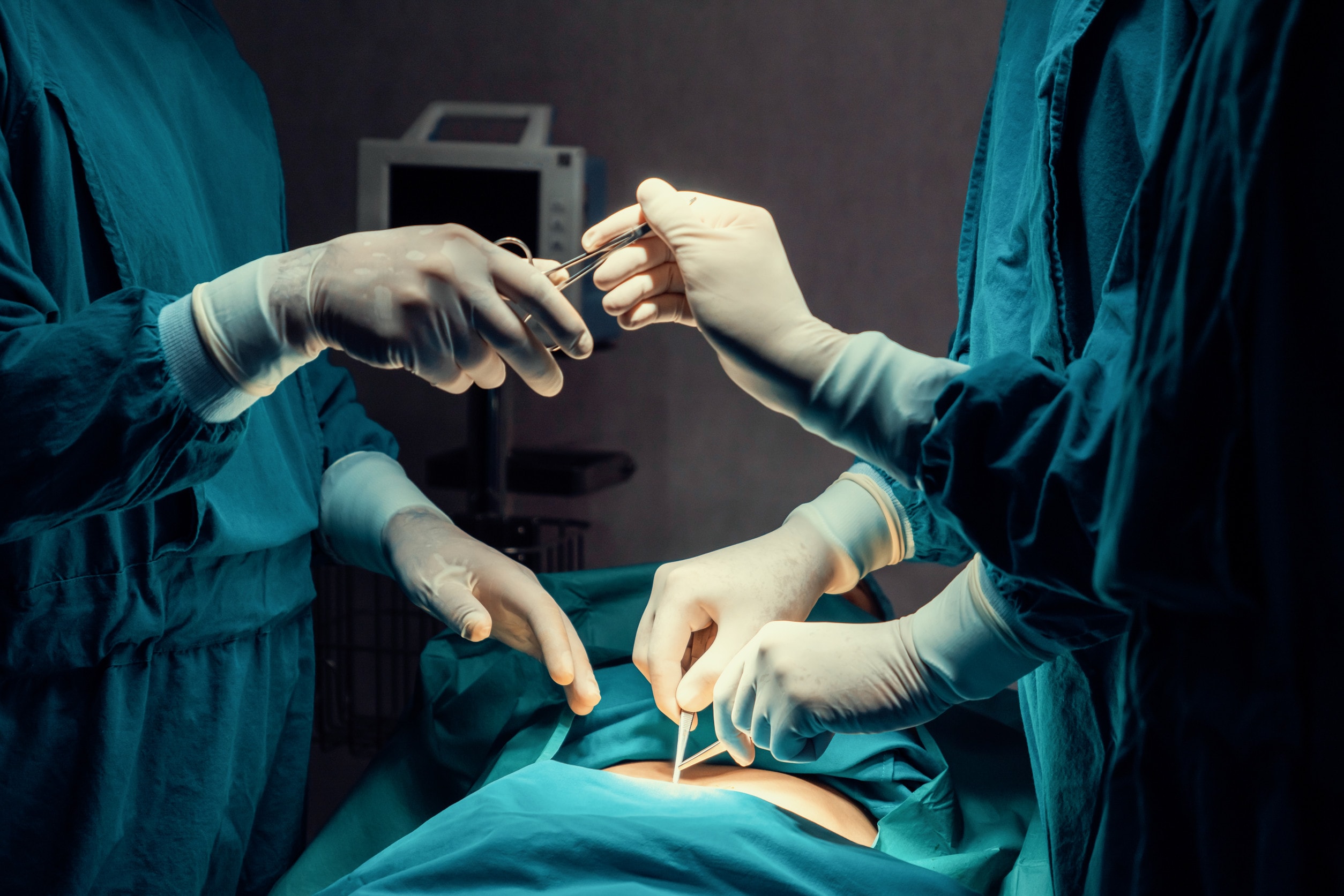 Un chirurgo che esegue una procedura di correzione post liposuzione.