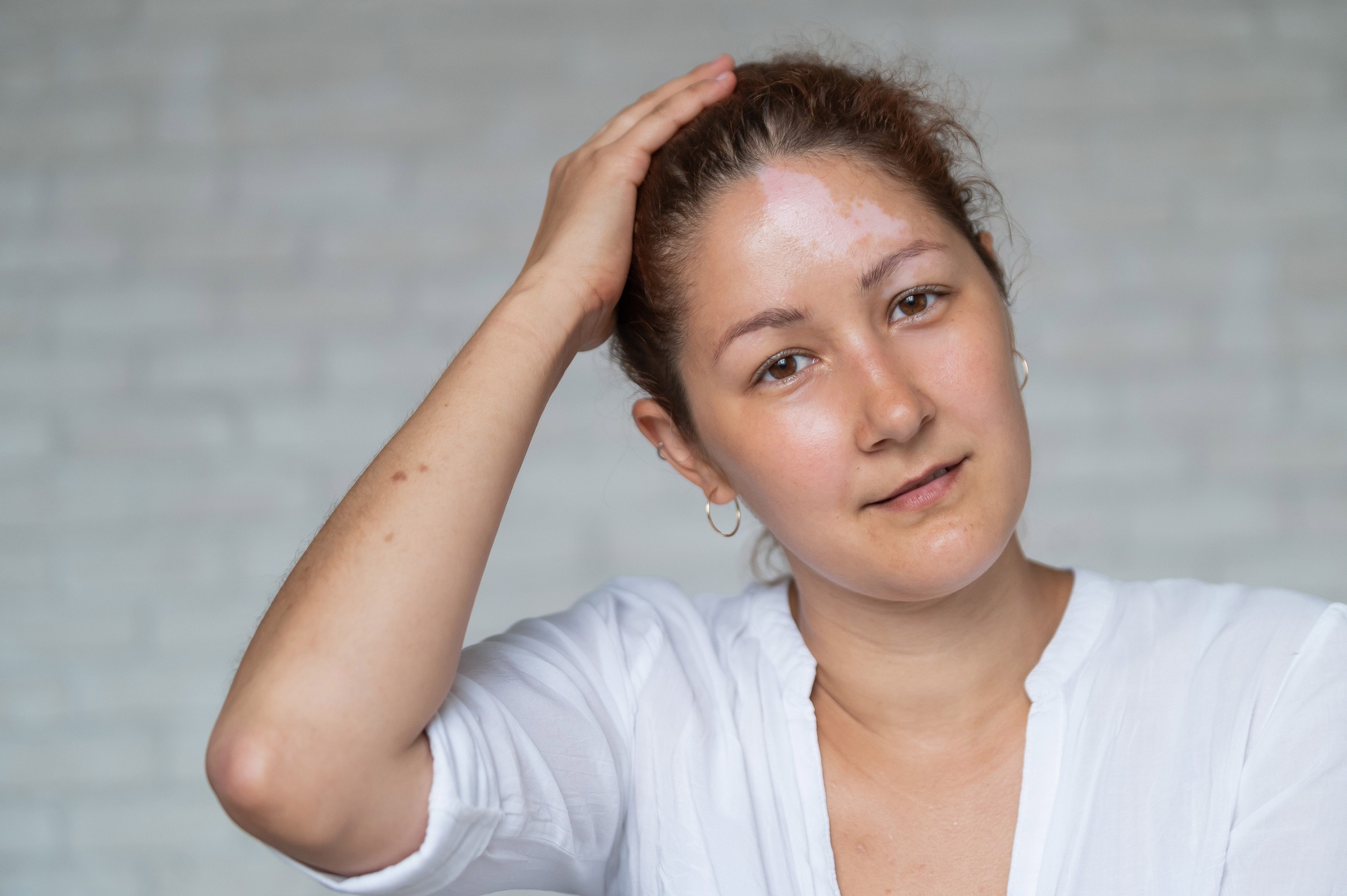 Una donna con i capelli diradati che mostra segni di perdita di capelli.