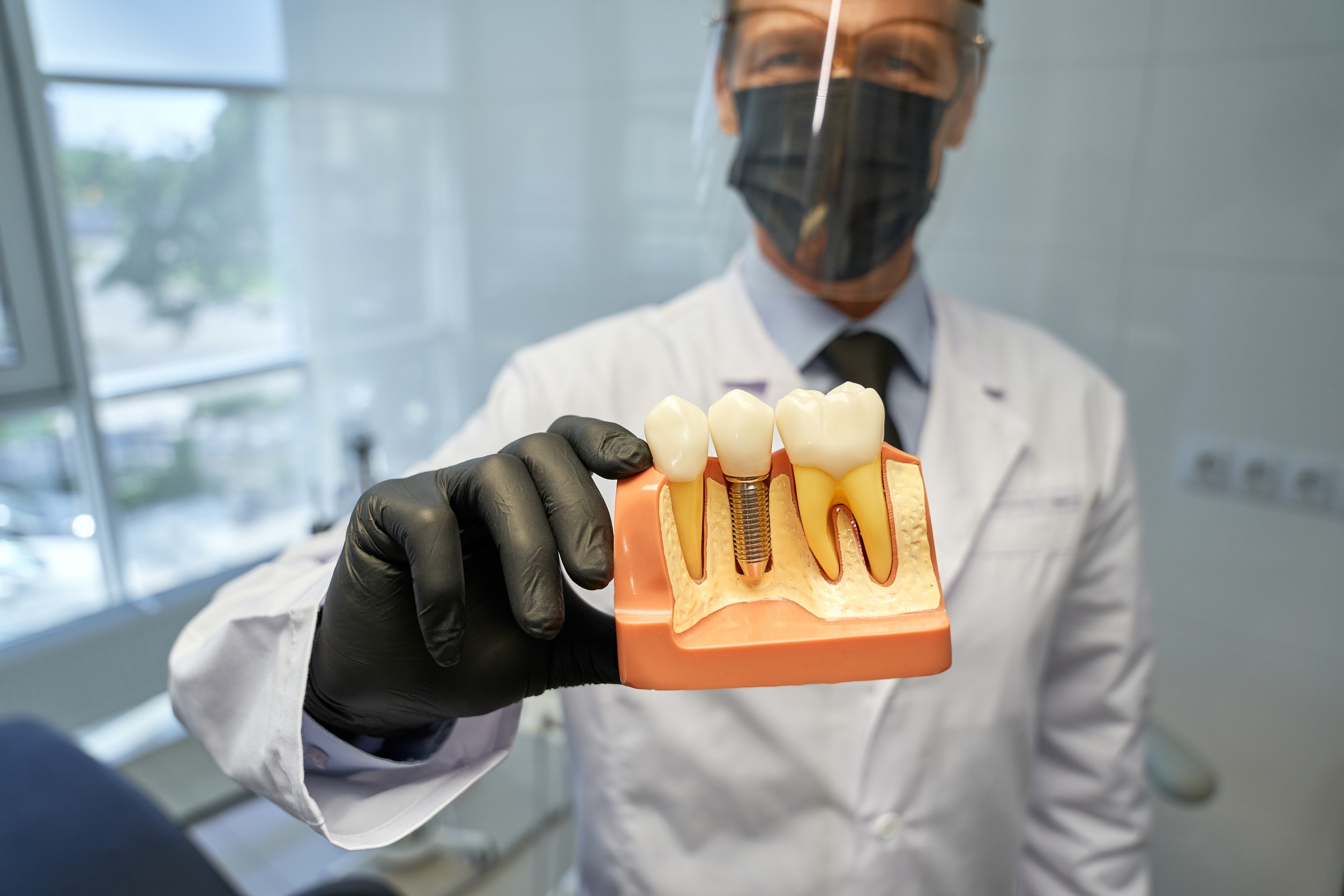Diagnosi e trattamento del rigetto degli impianti dentali.