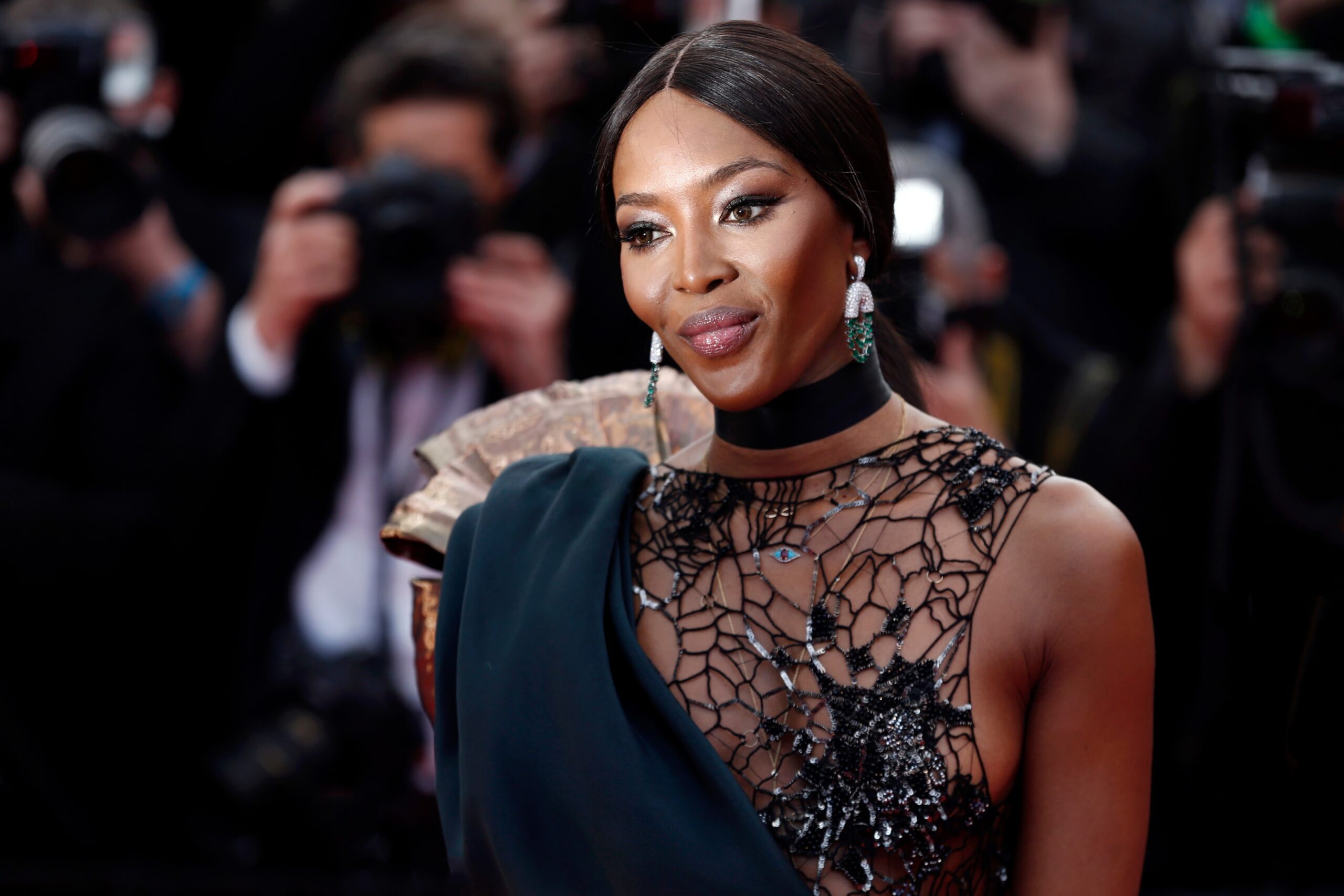 Naomi Campbell ha parlato pubblicamente degli effetti benefici di un trapianto di capelli