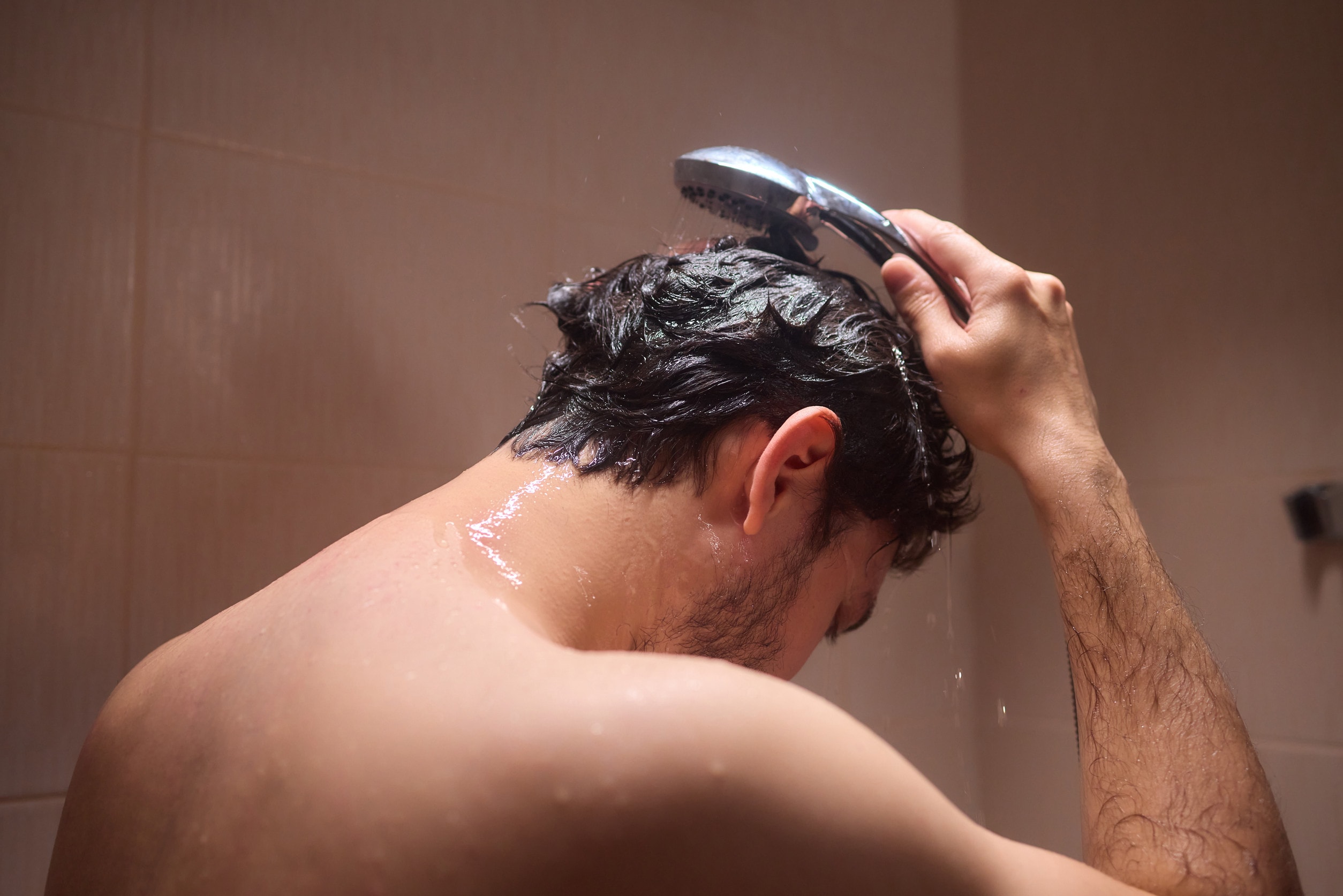Soluzioni per correggere un trapianto capelli andato male.