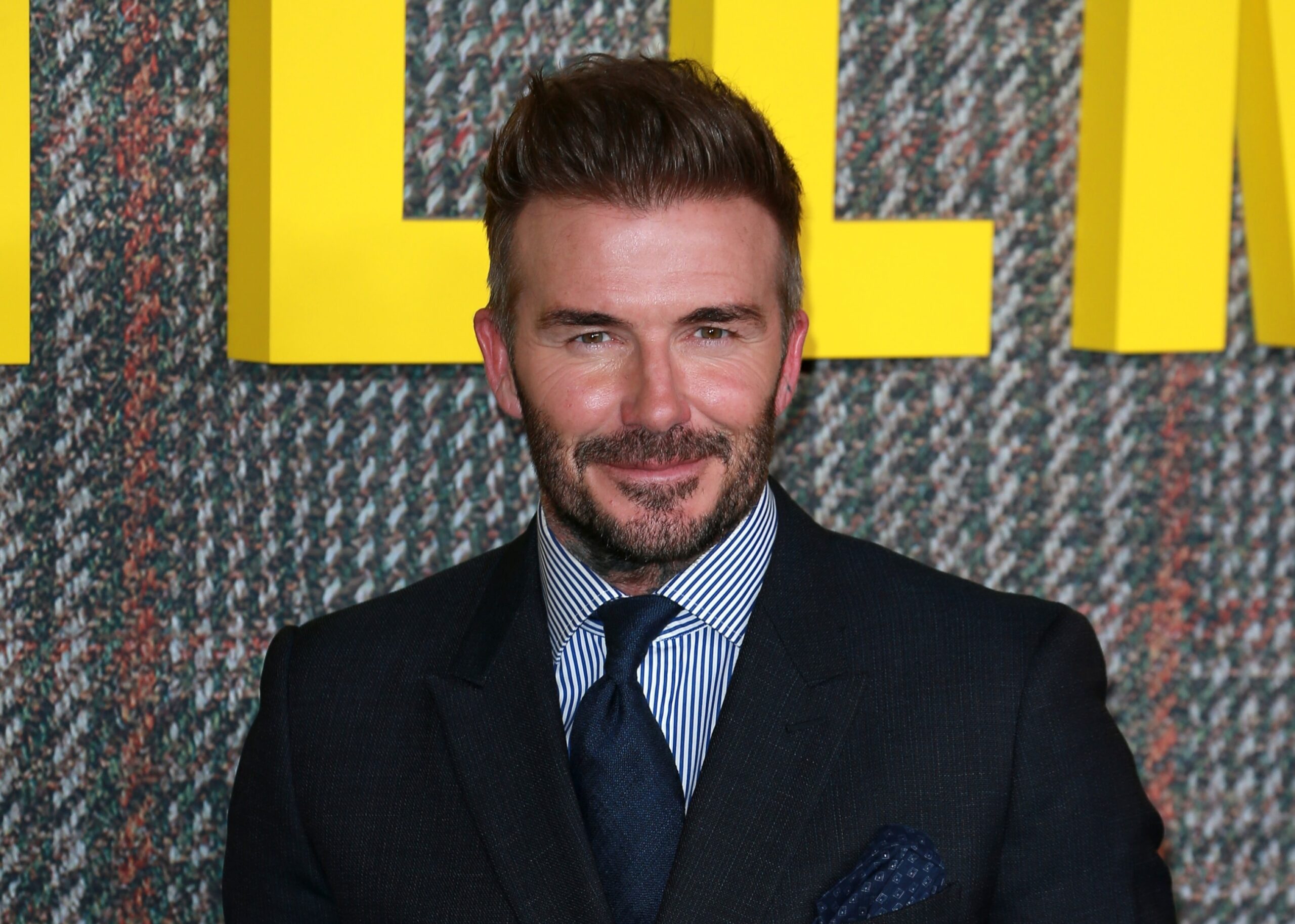 David Beckham ha usato il trapianto per ripristinare l'attaccatura dei capelli