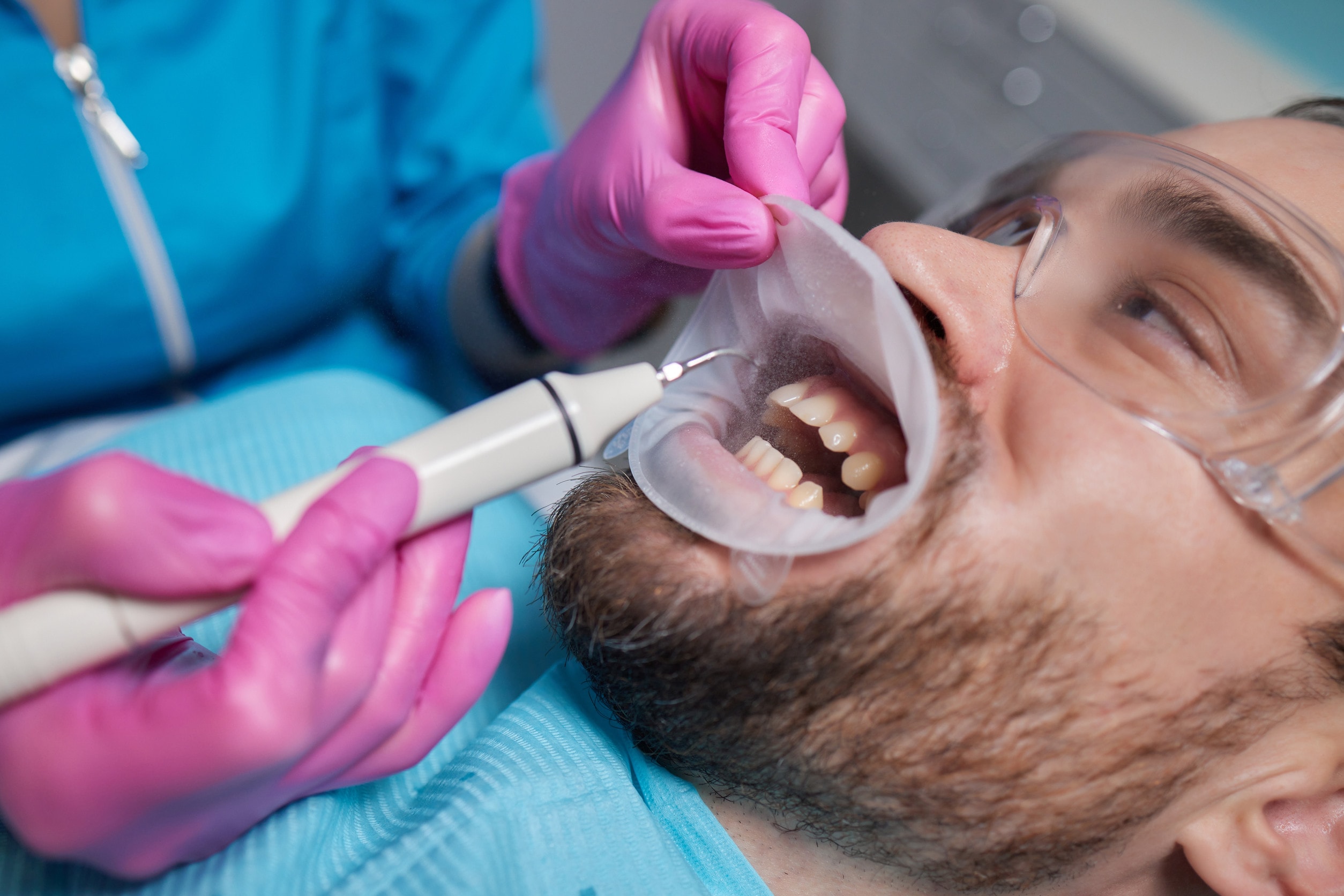 Procedura per l'inserimento degli impianti dentali senza viti.