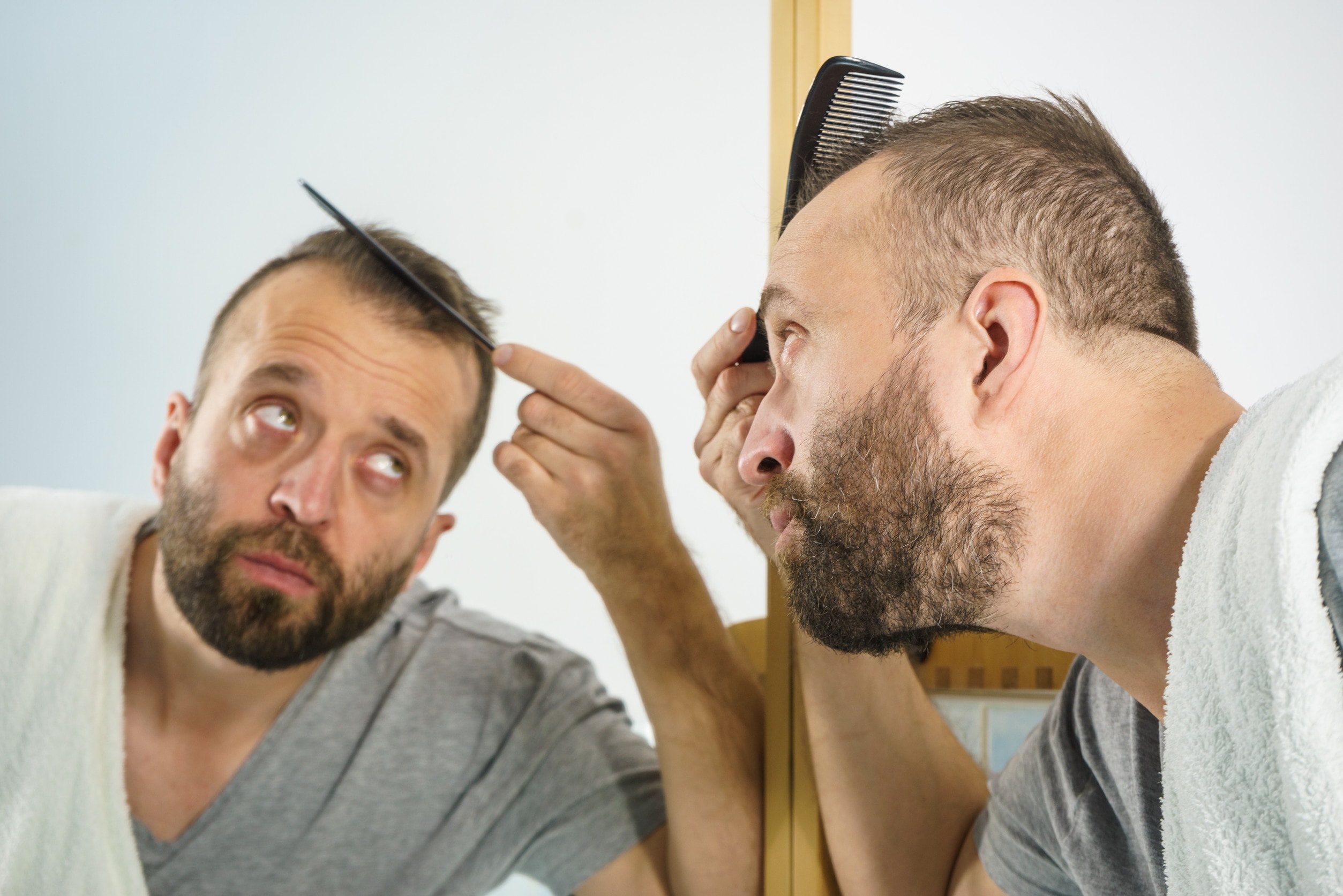 È importante avere aspettative realistiche riguardo al trapianto di capelli.